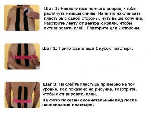 Тейпы кинезио можно ли при грыже позвоночника