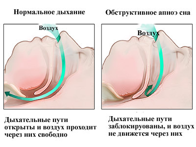 Гормоны