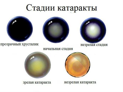 Бестоксол глазные капли