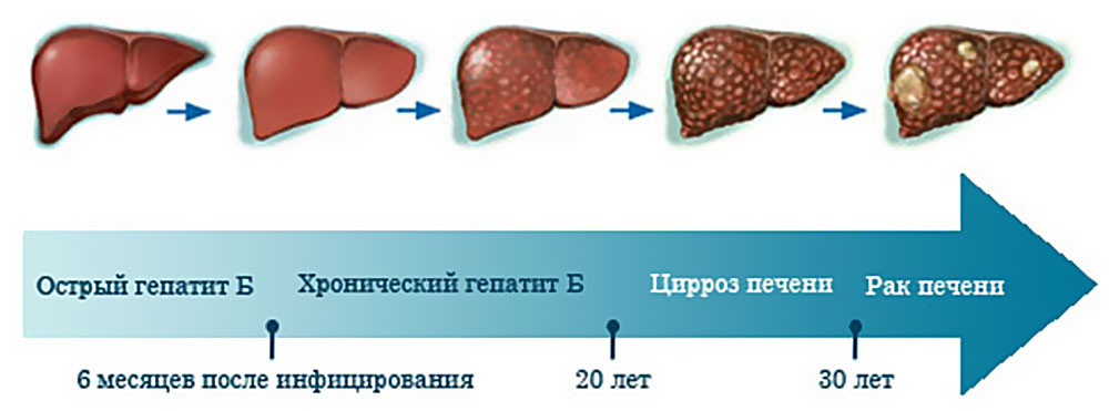 Морковь при гепатите в