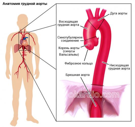 Аневризма брюшной аорты. причины, симптомы, признаки, диагностика и лечение патологии