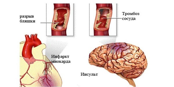 Клонидин – инструкция по применению, цена, отзывы и аналоги