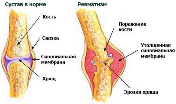 Почему возникают красные уплотнения на коже
