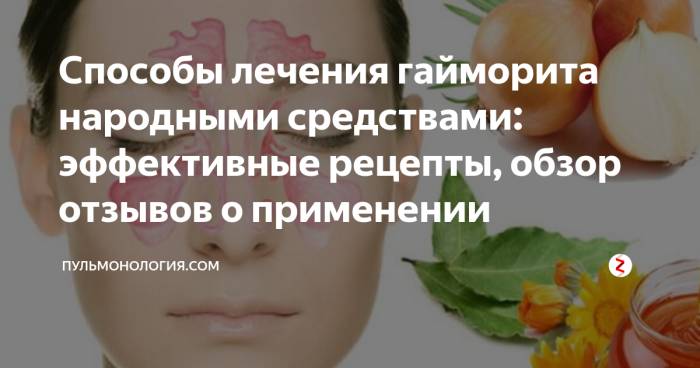Эффективное лечение гайморита народными средствами