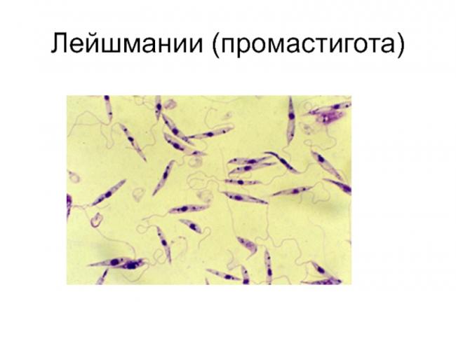 Акантамебиаз: причины заболевания, основные симптомы, лечение и профилактика