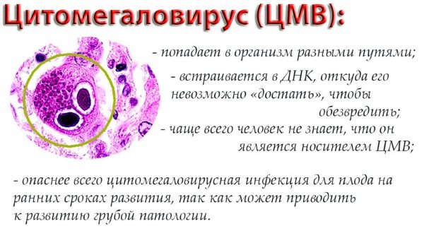 Цитомегаловирусная инфекция: симптомы, причины, диагностика, лечение, осложнения при цитомегаловирусе у беременных