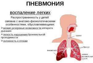 Характерные признаки пневмонии у ребенка