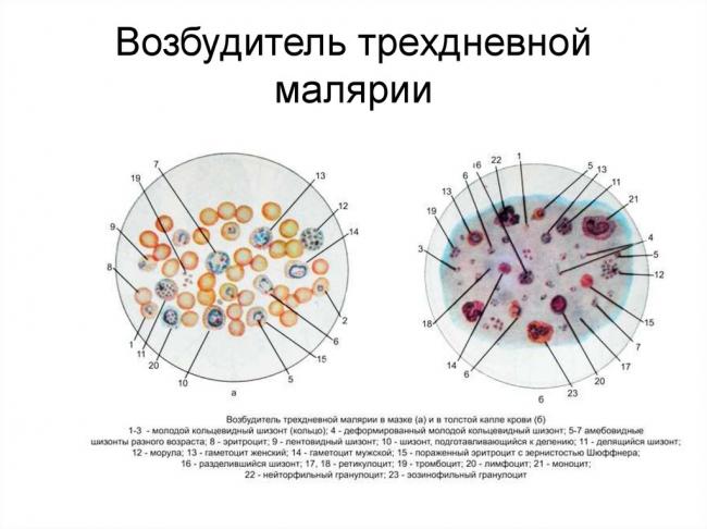 Амёба обыкновенная
