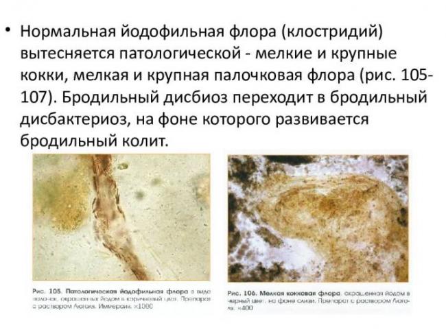 Йодофильная флора