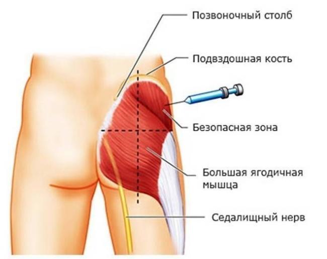 Витамины Фармстандарт Комбилипен Комплекс витаминов группы В в инъекциях - отзывы