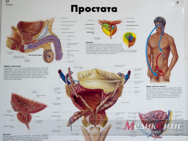 Воспаление простаты у мужчин: симптомы, причины, лечение