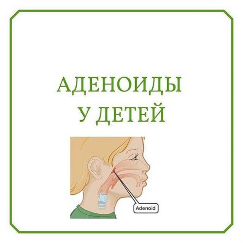 Эффективное лечение гайморита в домашних условиях