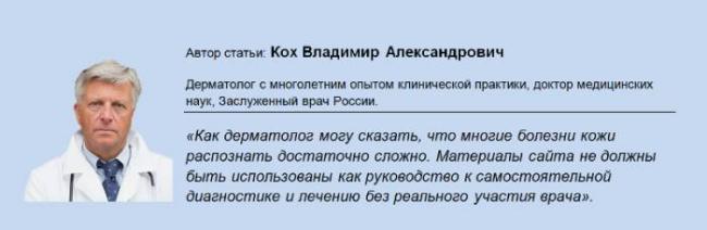 Почему чешутся и зудят коленки: причины и методы лечения