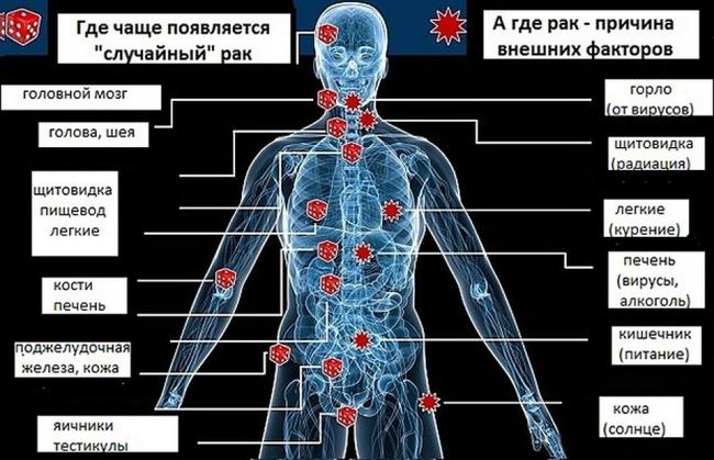 Рак языка - причины, стадии развития, хирургическое лечение, прогноз