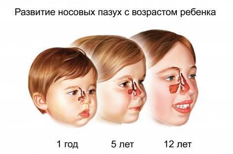 Грипп при беременности