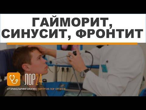 Катаральный фронтит (воспаление лобных пазух)