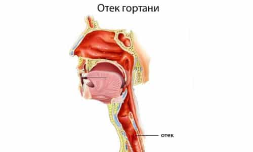 Тразикор