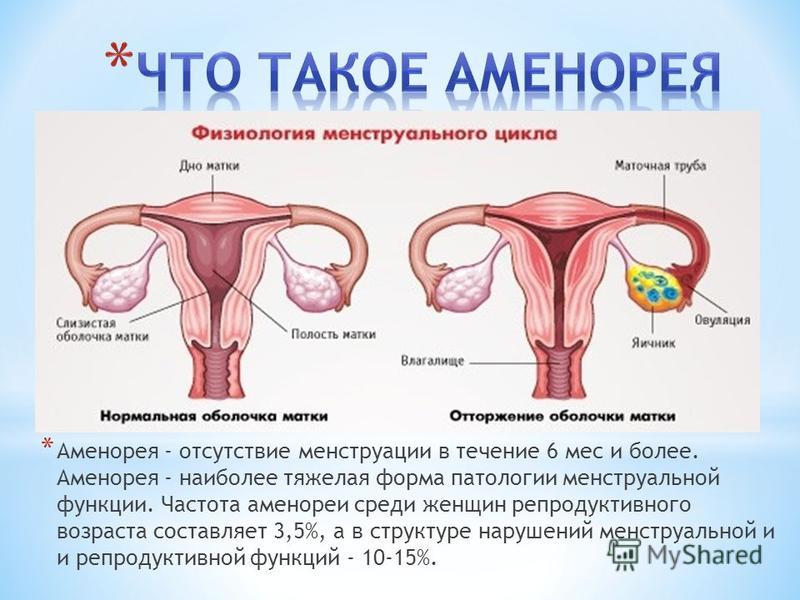 Как восстановить цикл месячных народными средствами