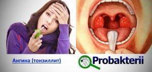 Бактерия стрептококк