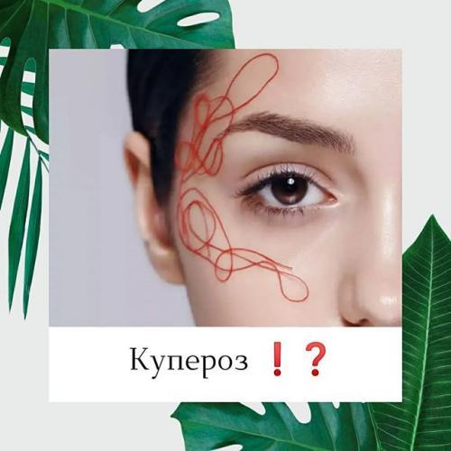 Как убрать сосудистые звёздочки на носу, ногах, подбородке...