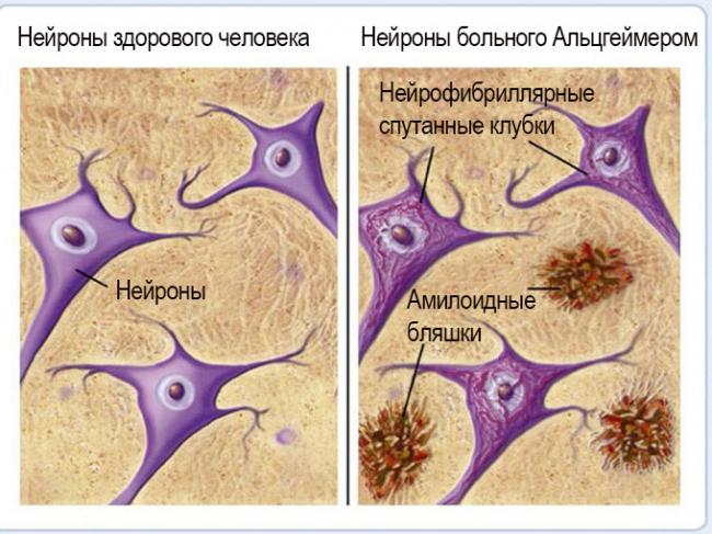 Вино помогает от стресса, болезней паркинсона и альцгеймера