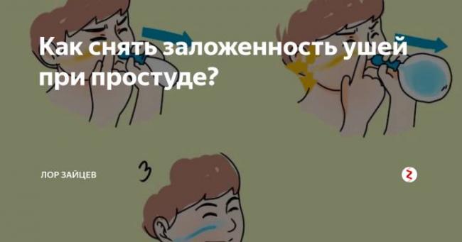 Заложенность в ушах. причины и лечение шума, звона, боли в горле, при насморке, от удара, после сна. чем капать