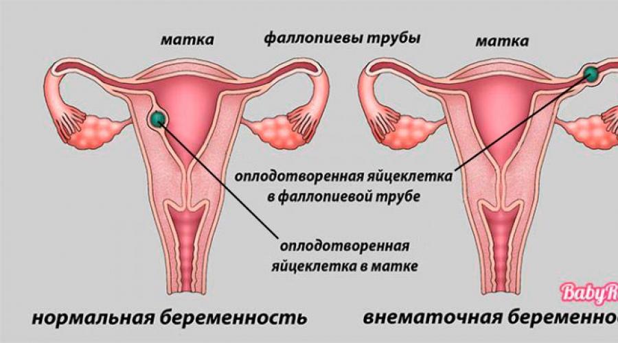 Первые признаки беременности до задержки: какие ранние симптомы до месячных говорят о беременности / mama66.ru