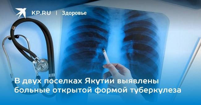 Лечится ли открытая форма туберкулеза легких. можно ли вылечить открытую форму туберкулеза