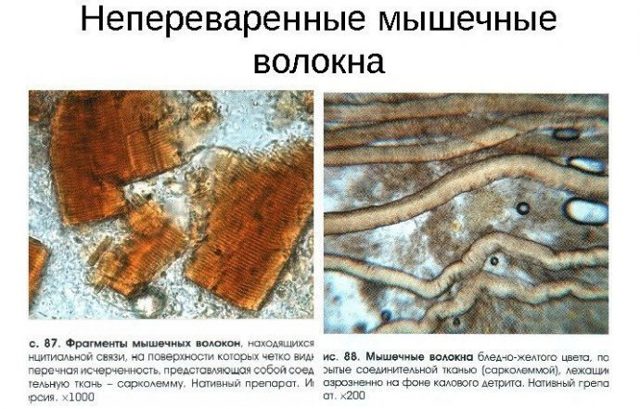 Слизь в кале у грудничка