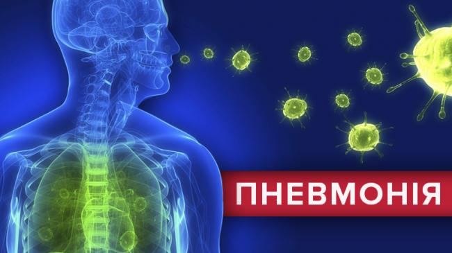Признаки пневмонии у ребёнка, чем их лечить, последствия