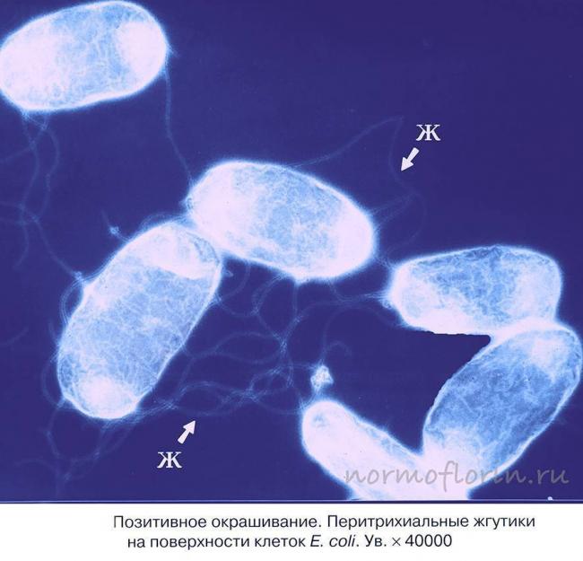 E. coli (кишечная палочка): чем она опасна?