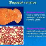 Если печень увеличена, что это значит у взрослых?