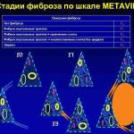 Что такое первичный и вторничный билиарный цирроз печени?