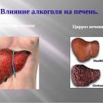 Вредно ли пиво для печени?