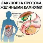 Колики в печени у женщины: что делать и как лечить?