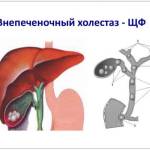 Чем лечить застой желчи в желчном пузыре?